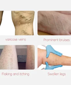 Fivfivgo™ Varicose Veins Relief Cream