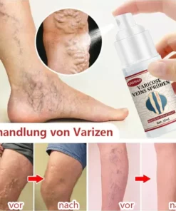 Fivfivgo™ VeinHealing Varizen Behandlungsspray