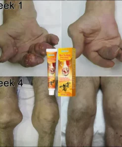 Flashing® New Zealand Bee Venom Professional Treatment Gel