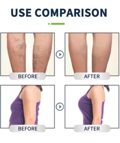 FootRev™ Detox Herbal Foot Soak Bag for Body Slimming