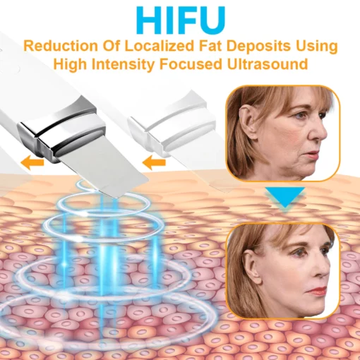 Instrumento de estiramiento facial GFOUK™ HIFU