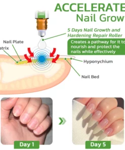 GFOUK™ 5 Days Nail Growth and Hardening Repair Roller