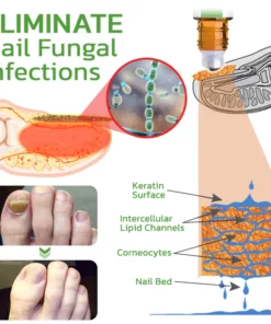 GFOUK™ 5 Days Nail Growth and Hardening Repair Roller