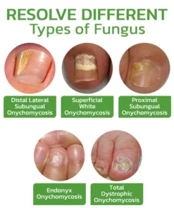 GFOUK™ 5 Days Nail Growth and Hardening Repair Roller
