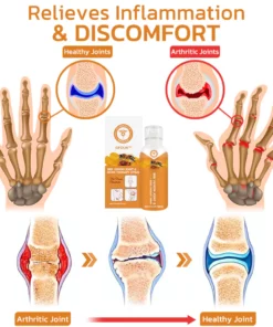 GFOUK™ Bee Venom Joint and Bone Therapy Spray