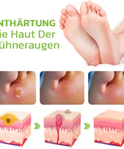 GFOUK™ IHerbal Fuß Schwielen und Hühneraugen Entfernung Soak