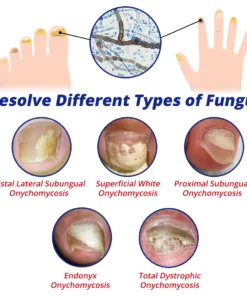 GFOUK™ NailFortify Rapid Growth Treatment Serum