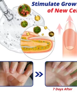 GFOUK™ NailFortify Rapid Growth Treatment Serum