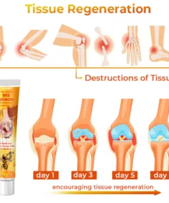 GFOUK™ New Zealand Bee Venom Professional Treatment Gel