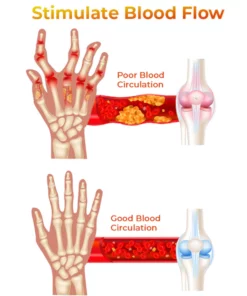 GFOUK™ New Zealand Bee Venom Professional Treatment Gel