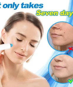 GFOUK™ Rapid Herbal Tag Removal Kit