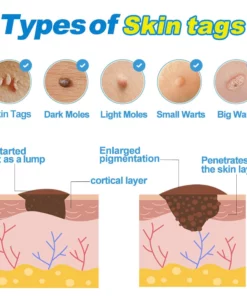 GFOUK™ Rapid Herbal Tag Removal Kit