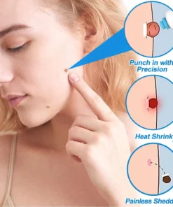 GFOUK™ Rapid Herbal Tag Removal Kit