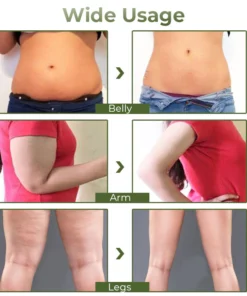 GFOUK™ Slimming and Fat Burning Cream