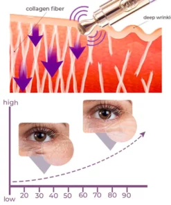 GFOUK™️ Milk Spots Therapy Vibration Serum Pen