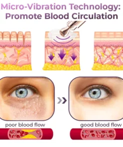 GFOUK™️ Milk Spots Therapy Vibration Serum Pen