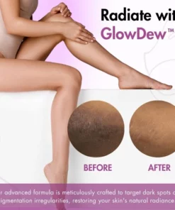GlowDew™ Intimate Whitening Cream