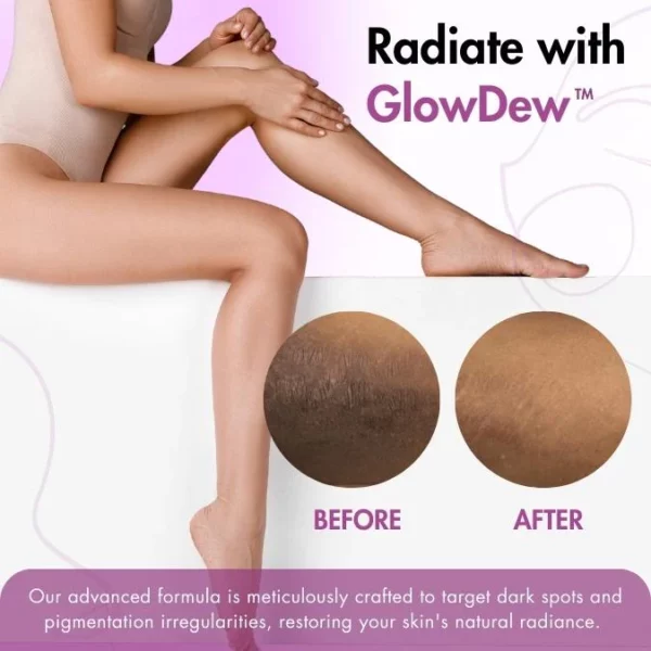 GlowDew™ Intimate Whitening Cream