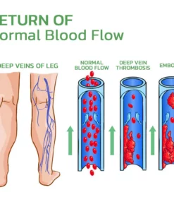 HealLegs™ Fat Burning Shaping & Varicose Veins Immediate Relief Burst Beads Patch