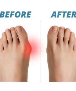 Alternative view of HealthGuard™Premium Bunion Corrector Sock