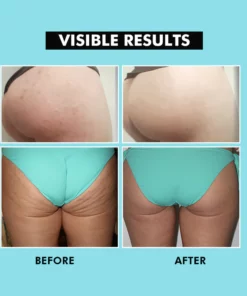 HipShine™Perfect Butt Mask