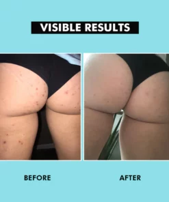 HipShine™Perfect Butt Mask