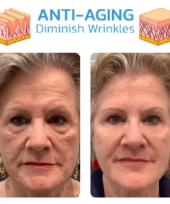 KK™ 30 Day Anti-Aging Treatment Serum