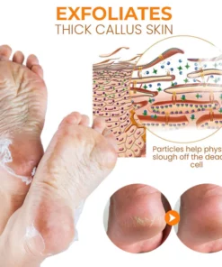 Alternative view of KK™ PediSoft Foot Callus Removal Spray