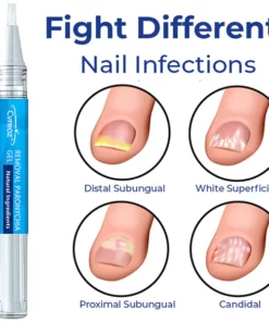 LEFUN Removal Paronychia Gel