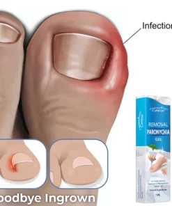 LEFUN Removal Paronychia Gel