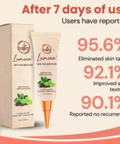 Alternative view of Lumina™ Skin Tag Remover