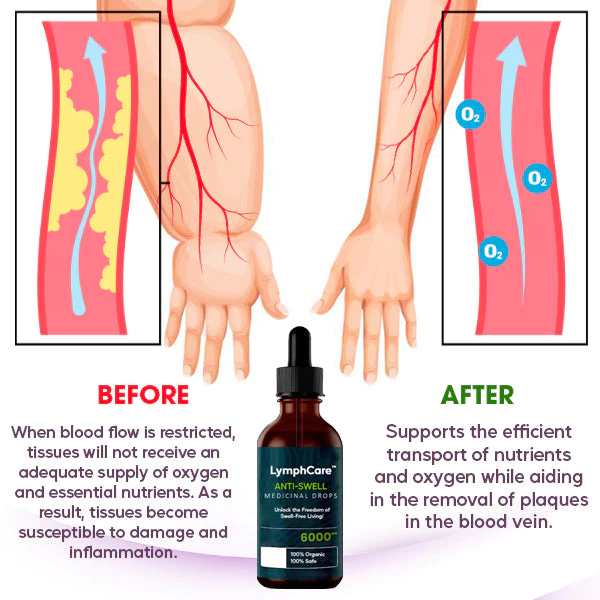LymphCare™ Anti-Swell Medicinal Drops - Image 4