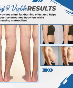 Magnetic Slimming Shoe Pad