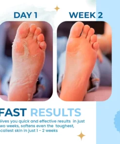 MilkySkin 3D Intense Exfoliating Foot Pad