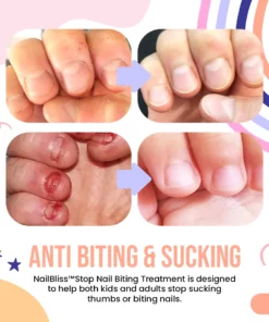 NailBliss™Stop Nail Biting Treatment