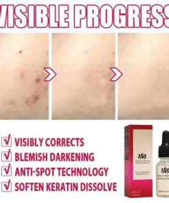 ORGANIC DARK SPOT SKIN SERUM