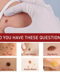 ORGANIC DARK SPOT SKIN SERUM