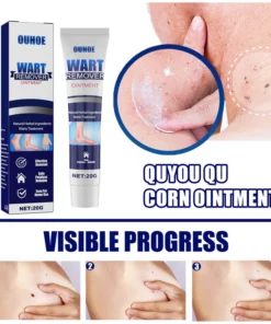 OUHOE™ Tags & Moles Remover