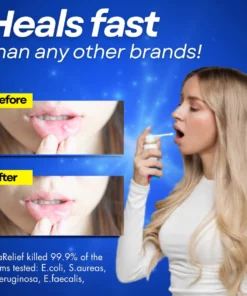 OraRelief™ Mouth Ulcer Spray