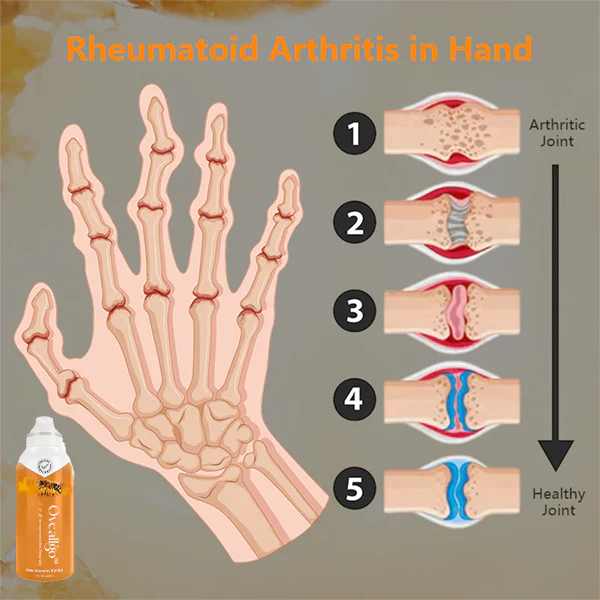 Oveallgo™ Bee Venom PURE Joint & Bone Therapy Spray - Image 4