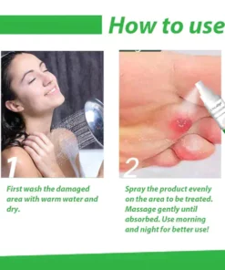 Oveallgo™ Corn Remover Power Spray