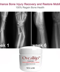 Oveallgo™ FlexiCure Joint & Bone Therapy Cream