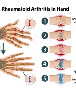 Oveallgo™ FlexiCure Joint & Bone Therapy Cream