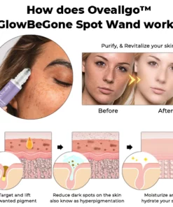 Oveallgo™ GlowBeGone Spot Wand