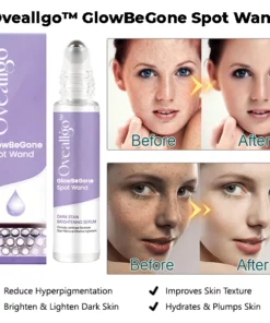 Oveallgo™ GlowBeGone Spot Wand