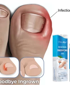 Oveallgo™ Removal Paronychia Gel