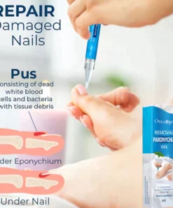 Oveallgo™ Removal Paronychia Gel