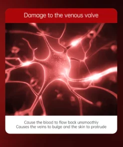 Oveallgo™ Varicose Veins Relief Cream