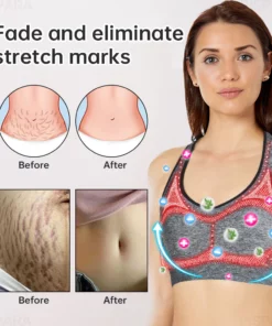LUCKYSONG™ Ion Lifting & Lymphvity Detoxification rinnahoidja