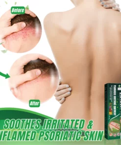 PUREX™ PSORIASIS SOOTHING OINTMENT